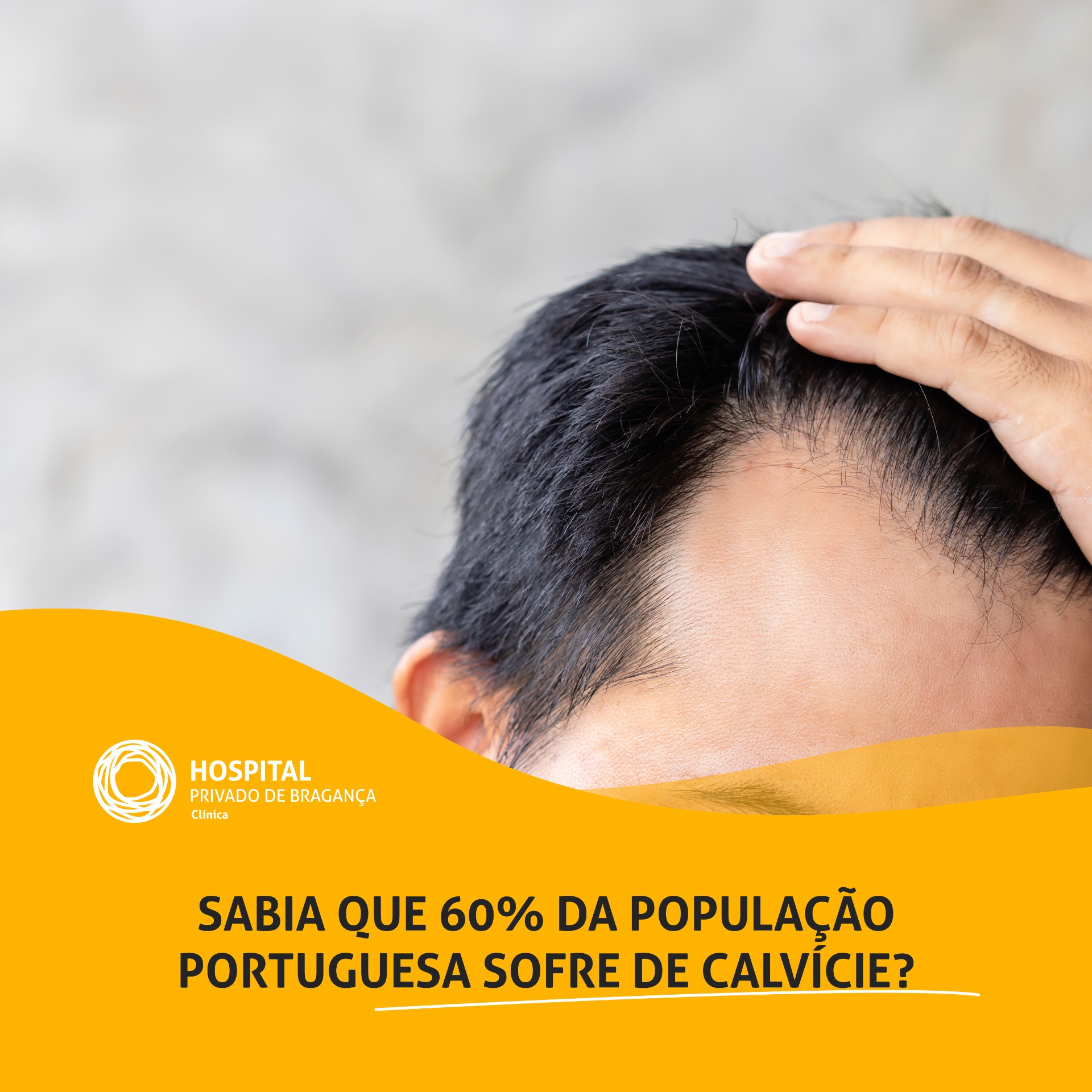 A calvície é um dos problemas mais temidos por qualquer pessoa